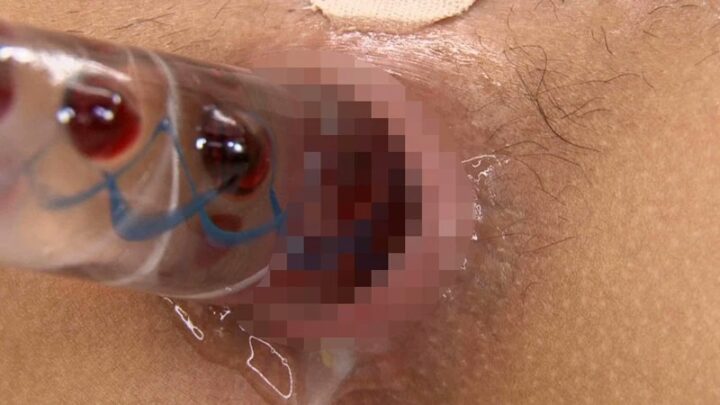 Screenshot 19 from DYNS-031 Takazawa Saya, Fukada Rina Anal Sensation Development: Aggressive Sphincter Examination, Yanusu