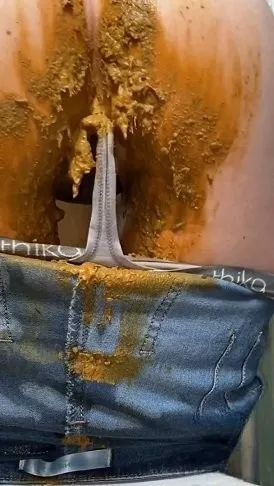 Screenshot 3 aus 27.05.2020 Sexandcandy18 Extremunfall mit Jeans