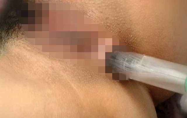 Screenshot 7 from NEWS-125 Big Ass Medical Checkup: Anal News (ei Ten)