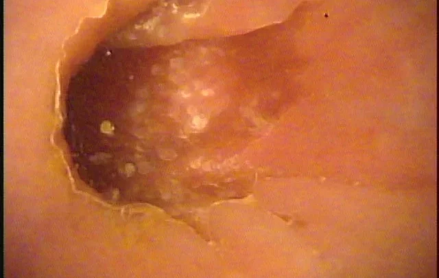 Screenshot 4 from NEWS-125 Big Ass Medical Checkup: Anal News (ei Ten)