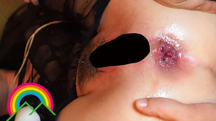 Screenshot 19 from SOAN-057 Haruka Anal Inspection Report: S-Shaped Curved Womb Repeatedly Penetrated, Reaching Orgasm Multiple Times with a Dual-Penetration Flesh Machine in Aomori City, Forestry Worker Age 28 Koumon Houmon